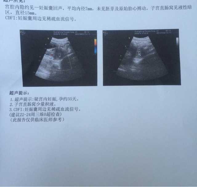 北京有经验的助孕中心