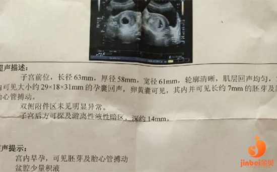 北京哪里有供卵机构,【北京哪里有供卵试管机构】9月7号预产期，8月31日顺产男
